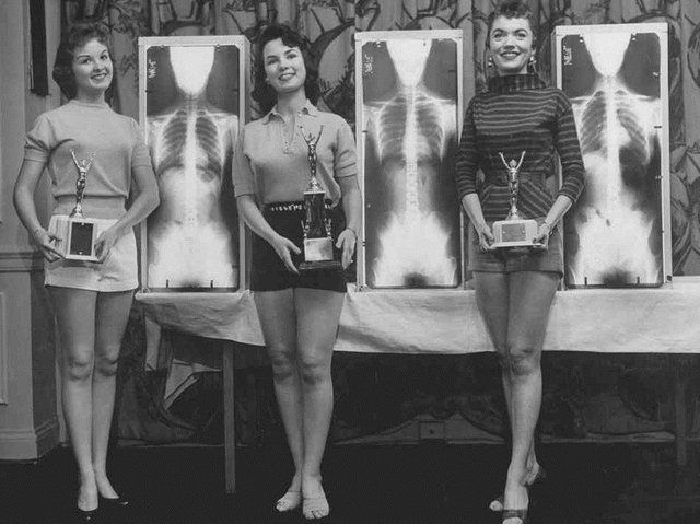 Contests For The Skeleton